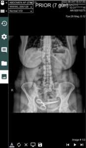 Read more about the article X-Ray Reveals Reason For Woman’s Stomach Pains