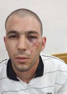 Read more about the article Israeli Cops ‘Marked Arab Suspect’s Face With Star of David’