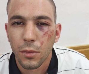 Israeli Cops ‘Marked Arab Suspect’s Face With Star of David’